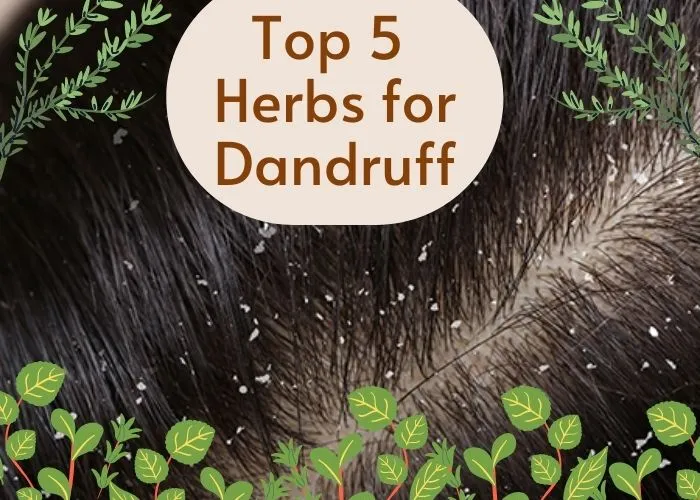 Top 5 Herbs for Dandruff